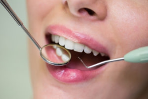 WHY A REGULAR DENTAL CHECKUP IS IMPORTANT?