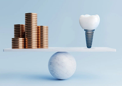 Discover the Benefits of All-on-4 Implants in Chennai