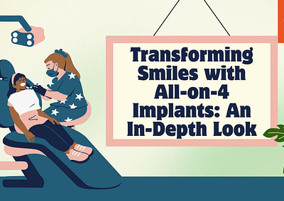 Transforming Smiles with All-on-4 Implants: An In-Depth Look